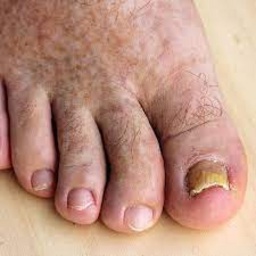 GoonersIncooperated-BestModsToGoonTo icon